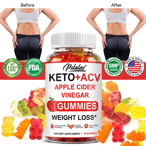 Advanced Weight Loss Keto Acv Gummies