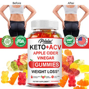 Advanced Weight Loss Keto Acv Gummies